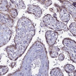 FAM3C Antibody, Novus Biologicals 0.1mL; Unlabeled:Antibodies, Polyclonal